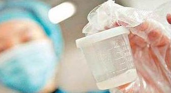 详细解读湘潭市做长方案试管婴儿费用，长方案和短方案成功率有差别吗？