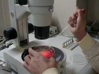 无精症可以做试管吗？有做成功的吗？