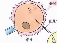 试管自然周期移植步骤全解析，四大注意事项助你顺利过关！