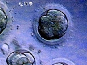 衡水三代试管婴儿医院哪家好？这几家试管医院更好